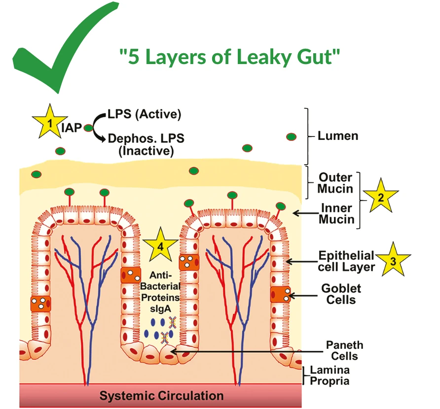 5 Layers of Leaky Gut